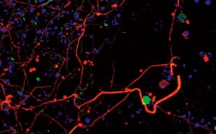 Embryonic Stem Cell Differentiation into Nervous System Cell