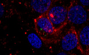 Localization Imaging of Exosomes