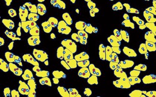 Counting Chromosomes in a Nucleus