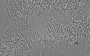 Quantifying Hyphal Concentration Using an Image Cytometer (ICM)