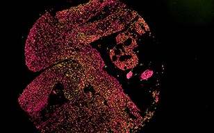 Stitching, Sectioning and the Z-Stack Function as Decisive Arguments for the Acquisition of the BZ Fluorescence Microscope at the University Hospital of Düsseldorf