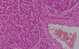 Observation of Liver Tissue