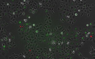 Cell Cycle Observation of an Oral-derived Epithelial Cell Line (Ca 9-22) Using FUCCI