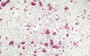 Osteoclast Well Plate Scanning