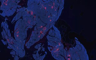 Visualizing the α and ß Cells of the Islets of Langerhans