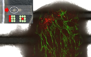 Non-invasive Observation of a 3D Structure Including Rectal Cancer Cells