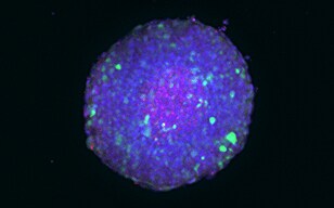 Observing Spheroids and Organoids