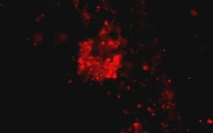 Differentiation Induction of Mouse iPS Cells for Cardiac Muscle