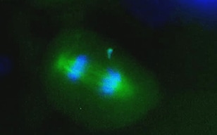 Time-lapse Imaging and Observation of Cell Division