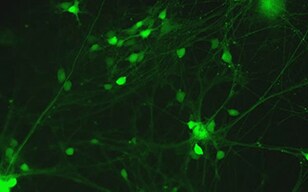 Activity of iPS Cell-derived Nerve Cells