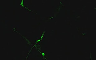 Axonal Elongation of Neural Progenitor Cells (PC12)
