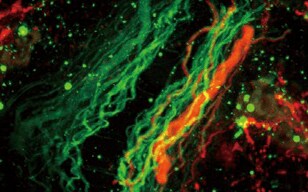 Observation of a Zebrafish Spinal Cord