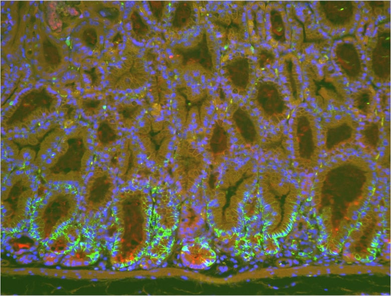 Image: Fluorescent magnified image of stomach before using the haze reduction function