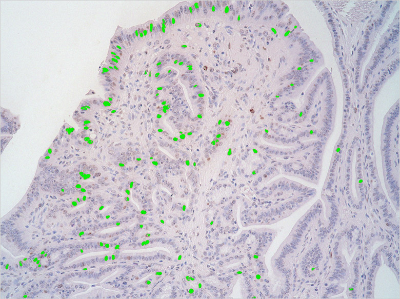 Image: Image after using the cell count function
