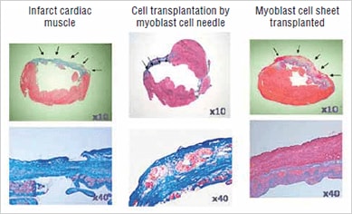 Image: From the left, comparative images of: heart...