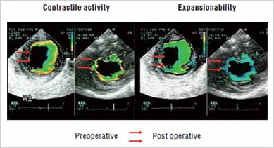 Image: Transplant results of a myoblast cell sheet...