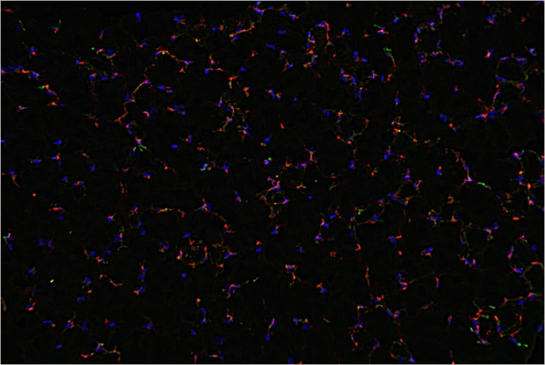 This picture was sharpened using the haze reduction function. The bone marrow cells and blood vessels are clearly shown.