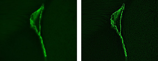 Images: Stained magnified images of ependyma cells of an adult mouse...