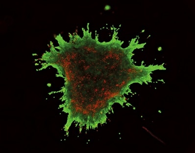 With integrin (cell adhesion molecule)