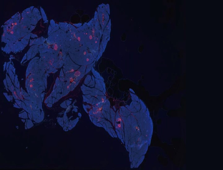 Capturing high-resolution images