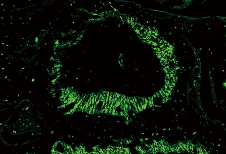Capturing clear images without fluorescence blurring