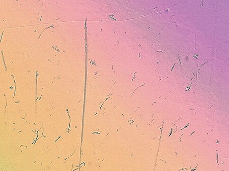 Differential interference contrast (DIC) image (400x)