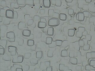 Normal (1500x)