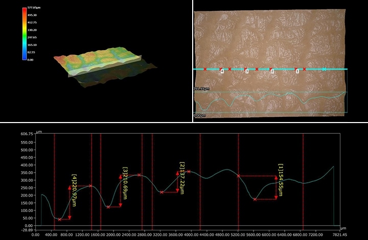 3D profile of skin surface