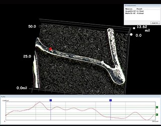 Bioabsorbable stent 3D shape and profile measurement
