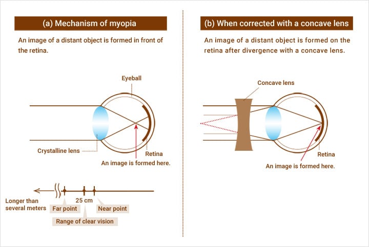 Spherical Vision Systems