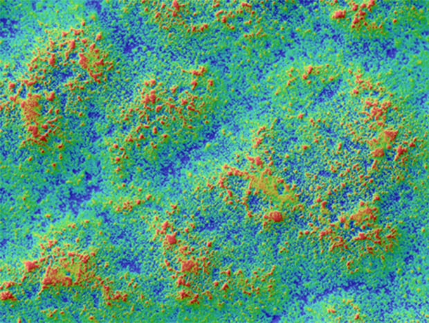 Observation and Measurement of Textured Surfaces Using Digital Microscopes